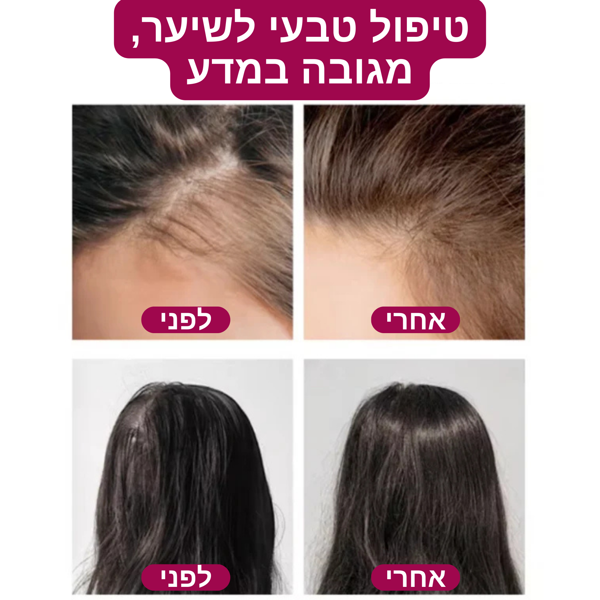 מברשת עיסוי ™HairGuard